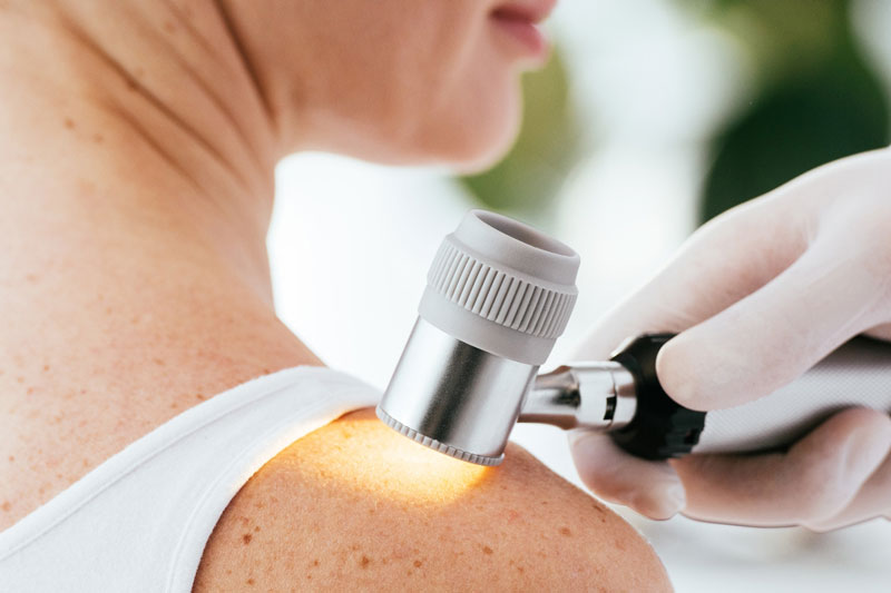 A dermatologist checks a patient’s shoulder for a potential skin condition.