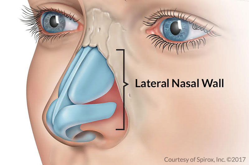 An illustration of the lateral nasal wall and anatomy of the nose.