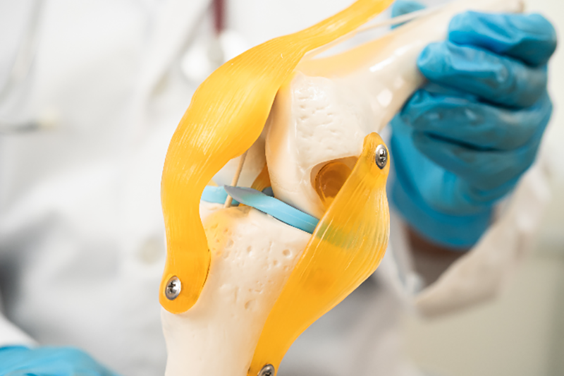 A doctor holds an educational model of a knee joint at Ascentist Healthcare in Kansas City